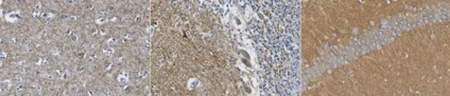 Anti-GluR2 Antibody, clone 14C12.2 clone 14C12.2, from mouse