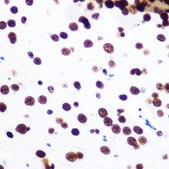 Anti-SFPQ antibody produced in rabbit