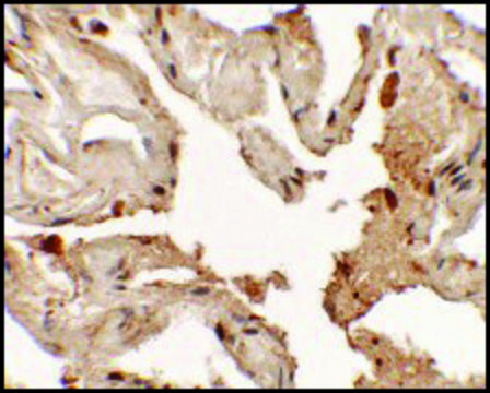 Anti-NKX2-1 antibody produced in rabbit affinity isolated antibody