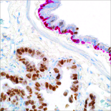 Cytokeratin 5 &amp; 6 (D5/16B4) + TTF-1 (8G7G3/1) Mouse Monoclonal Antibody