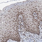 Anti-ZC3H13 antibody produced in rabbit Prestige Antibodies® Powered by Atlas Antibodies, affinity isolated antibody, buffered aqueous glycerol solution