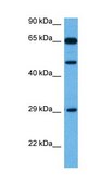 Anti-TP73 antibody produced in rabbit affinity isolated antibody