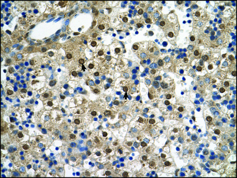 Anti-SQLE antibody produced in rabbit affinity isolated antibody