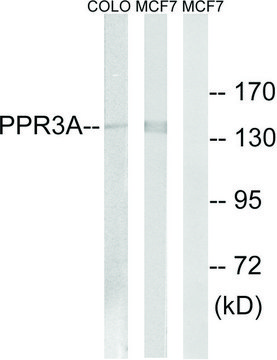 Anti-PPP1R3A antibody produced in rabbit affinity isolated antibody