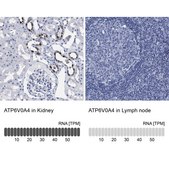 Anti-ATP6V0A4 antibody produced in rabbit Prestige Antibodies® Powered by Atlas Antibodies, affinity isolated antibody, buffered aqueous glycerol solution