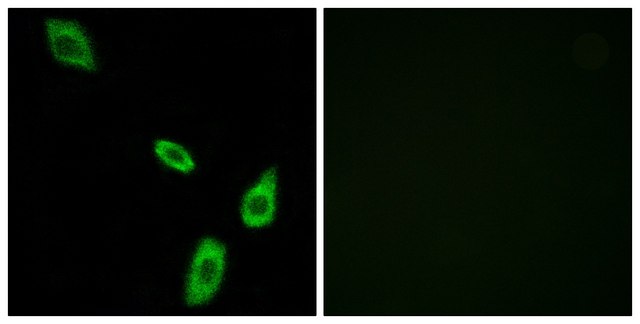 Anti-ADRA1B antibody produced in rabbit affinity isolated antibody