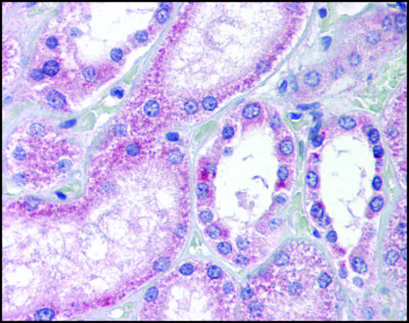 Anti-AADAT (AB2) antibody produced in rabbit affinity isolated antibody, buffered aqueous solution