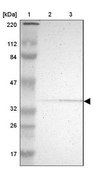 Anti-PDLIM2 antibody produced in rabbit Prestige Antibodies® Powered by Atlas Antibodies, affinity isolated antibody, buffered aqueous glycerol solution