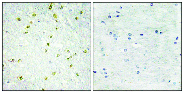 Anti-SNAPC5 antibody produced in rabbit affinity isolated antibody