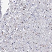 Anti-NRAP antibody produced in rabbit Prestige Antibodies® Powered by Atlas Antibodies, affinity isolated antibody, buffered aqueous glycerol solution