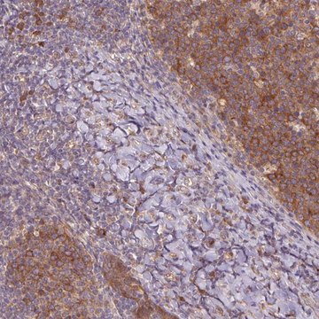 Anti-RRM1 antibody produced in rabbit Prestige Antibodies&#174; Powered by Atlas Antibodies, affinity isolated antibody, buffered aqueous glycerol solution