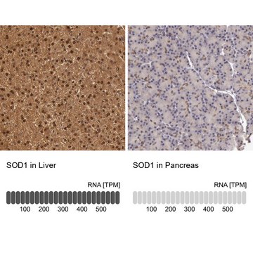 抗-SOD1 兔抗 Prestige Antibodies&#174; Powered by Atlas Antibodies, affinity isolated antibody, buffered aqueous glycerol solution