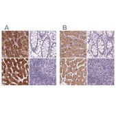 Anti-EPHX1 antibody produced in rabbit Prestige Antibodies® Powered by Atlas Antibodies, affinity isolated antibody, buffered aqueous glycerol solution