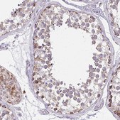 Anti-IFIT1 antibody produced in rabbit Prestige Antibodies® Powered by Atlas Antibodies, affinity isolated antibody, buffered aqueous glycerol solution