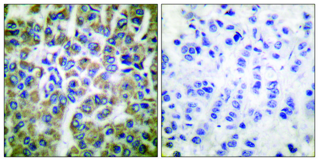 Anti-HSP10 antibody produced in rabbit affinity isolated antibody