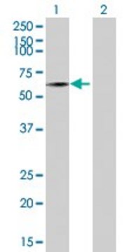 Anti-SEMA3B antibody produced in rabbit purified immunoglobulin, buffered aqueous solution