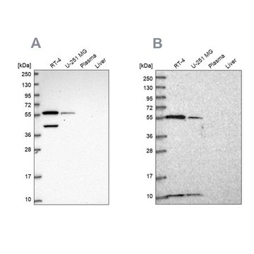 Anti-NUP50 antibody produced in rabbit Prestige Antibodies&#174; Powered by Atlas Antibodies, affinity isolated antibody