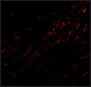 Anti-CIDE-A (ab1) antibody produced in rabbit affinity isolated antibody, buffered aqueous solution