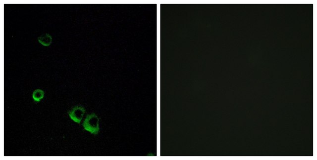 Anti-AVPR2 antibody produced in rabbit affinity isolated antibody