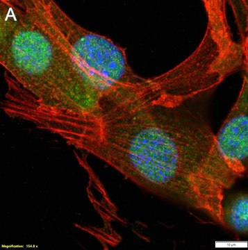 Anti-S100A4 Antibody, clone 1G2 ZooMAb&#174; Rabbit Monoclonal recombinant, expressed in HEK 293 cells