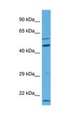 Anti-MBOAT1 antibody produced in rabbit affinity isolated antibody