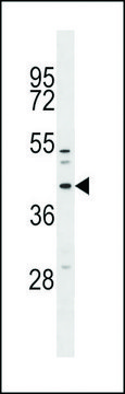 ANTI-MFF (CENTER) antibody produced in rabbit affinity isolated antibody, buffered aqueous solution