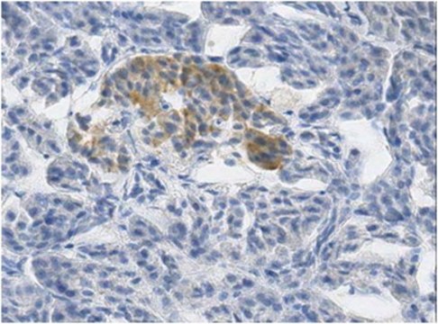 Anti-Betacellulin Antibody, clone 6G10.1 clone 6G10.1, from mouse