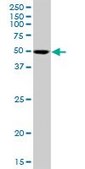Anti-SIL1 antibody produced in mouse purified immunoglobulin, buffered aqueous solution