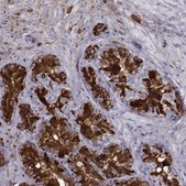 Anti-SEMG1 antibody produced in rabbit Prestige Antibodies® Powered by Atlas Antibodies, affinity isolated antibody, buffered aqueous glycerol solution