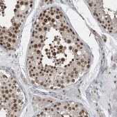 Anti-YTHDC1 antibody produced in rabbit Prestige Antibodies® Powered by Atlas Antibodies, affinity isolated antibody, buffered aqueous glycerol solution