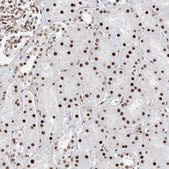 Anti-ZNF638 antibody produced in rabbit Prestige Antibodies® Powered by Atlas Antibodies, affinity isolated antibody, buffered aqueous glycerol solution