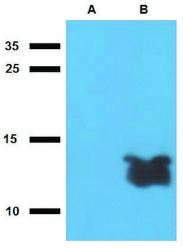 Anti-Tb7.7 (M. tuberculosis) antibody produced in rabbit