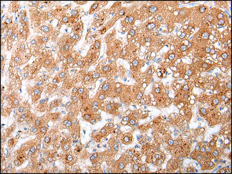 Anti-GLI3 affinity isolated antibody