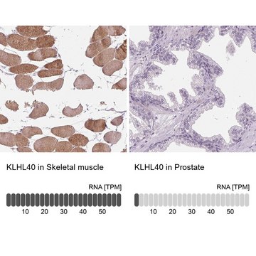 Anti-KLHL40 antibody produced in rabbit Prestige Antibodies&#174; Powered by Atlas Antibodies, affinity isolated antibody, buffered aqueous glycerol solution