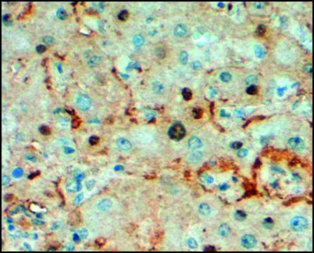 Anti-Triosephosphate Isomerase antibody produced in goat affinity isolated antibody, buffered aqueous solution