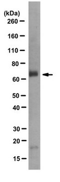 Anti-Myotubularin Antibody, clone 1G6 ascites fluid, clone 1G6, from mouse