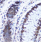 Anti-CTCF antibody produced in rabbit