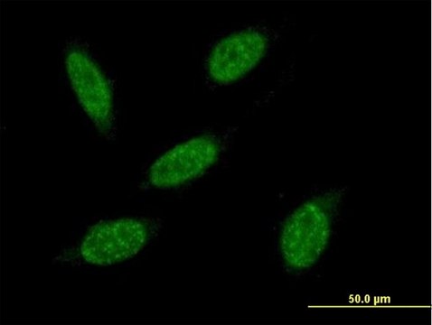 Anti-RNF20 antibody produced in mouse purified immunoglobulin, buffered aqueous solution