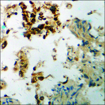 Anti-phospho-UBF (pSer484) antibody produced in rabbit affinity isolated antibody