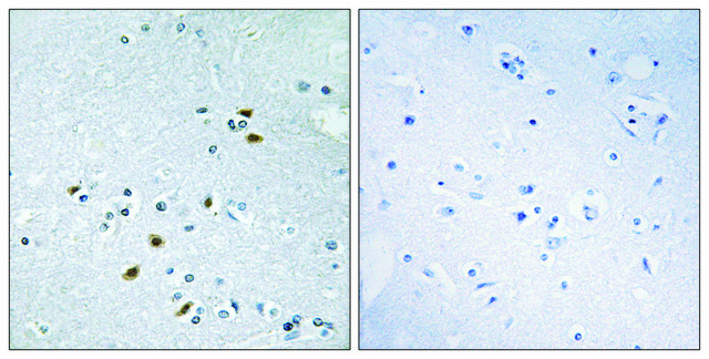 Anti-BRCA2 antibody produced in rabbit affinity isolated antibody