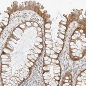 Anti-NEO1 antibody produced in rabbit Prestige Antibodies® Powered by Atlas Antibodies, affinity isolated antibody, buffered aqueous glycerol solution, ab3