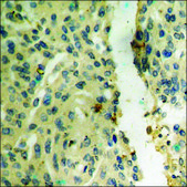 Anti-phospho-FAK (pTyr397) antibody produced in rabbit affinity isolated antibody