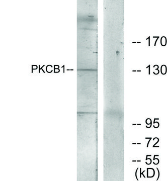 Anti-PKCB1 antibody produced in rabbit affinity isolated antibody