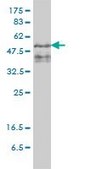 Monoclonal Anti-ZFYVE19 antibody produced in mouse clone 4D5-2D11, purified immunoglobulin, buffered aqueous solution