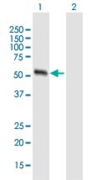 Anti-MMP13 antibody produced in mouse purified immunoglobulin, buffered aqueous solution