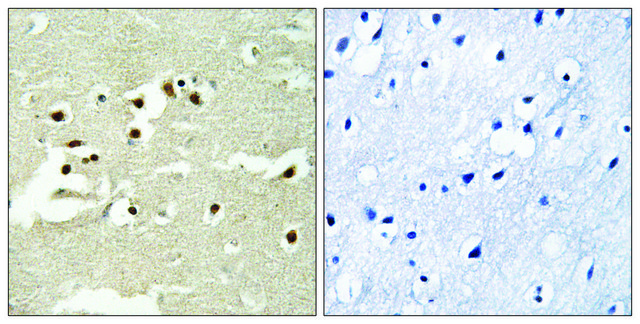 Anti-NCOA5 antibody produced in rabbit affinity isolated antibody