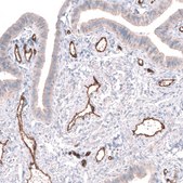Anti-PLVAP antibody produced in rabbit Prestige Antibodies® Powered by Atlas Antibodies, affinity isolated antibody, buffered aqueous glycerol solution