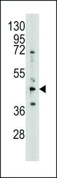 ANTI-S ADENOSYLHOMOCYSTEINE HYDROLASE (ACHY)(N-TERMINAL) antibody produced in rabbit purified immunoglobulin, buffered aqueous solution