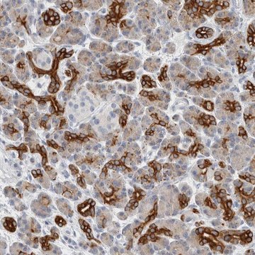 Anti-SLC28A3 antibody produced in rabbit Prestige Antibodies&#174; Powered by Atlas Antibodies, affinity isolated antibody, buffered aqueous glycerol solution, Ab2