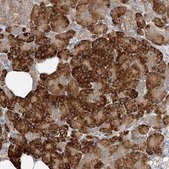 Anti-TMEM61 antibody produced in rabbit Prestige Antibodies® Powered by Atlas Antibodies, affinity isolated antibody, buffered aqueous glycerol solution